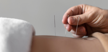 Imagem de Detalhes do Tratamento