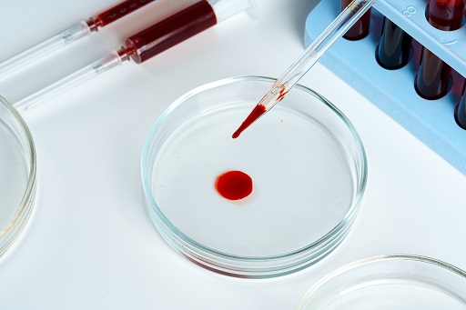 Acúmulo excessivo de ácido láctico no sangue, reduzindo seu pH e tornando-o ácido