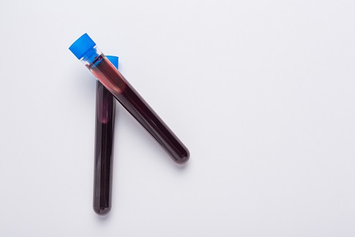 Distúrbio caracterizado pelo acúmulo de ácido ou perda de bicarbonato no organismo, resultando em um pH sanguíneo inferior a 7,35