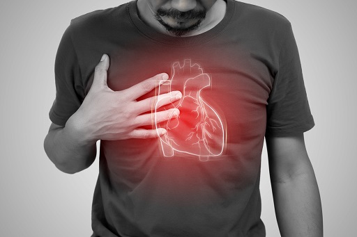 Bloqueio atrioventricular de grau II ou de grau III
