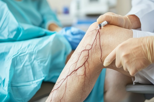 Condições que afetam o sistema circulatório, compreendendo artérias, veias e vasos linfáticos
