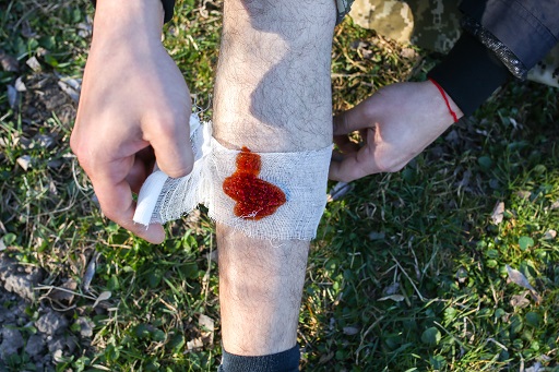 Perda de sangue por ruptura de vasos (interna ou externa), variando de leve a fatal (choque hipovolêmico)