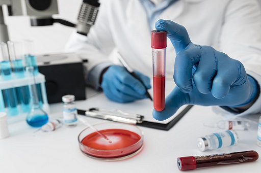 Presença de níveis elevados de ácido úrico no sangue