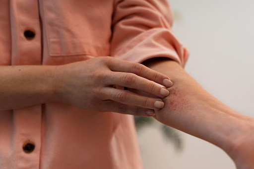 Lesões dermatológicas sólidas, circunscritas e palpáveis, que se elevam acima da superfície da pele