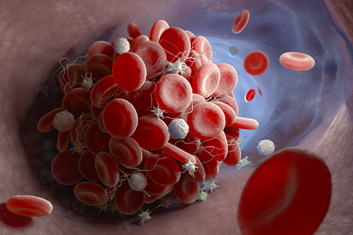 Alterações das células do sangue