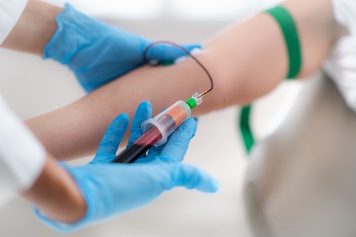 Hiperuremia