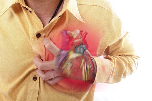 Derrame pericárdico