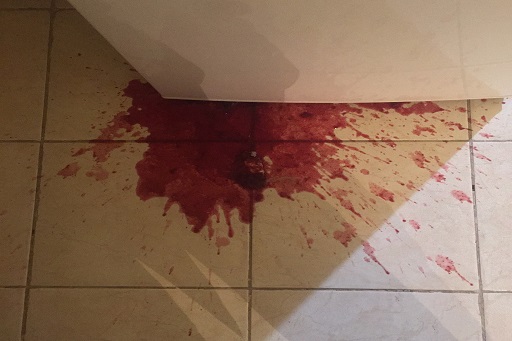 Diarreia com sangue