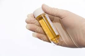 Oliguria