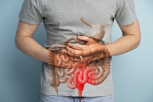 Infarto gastrointestinal