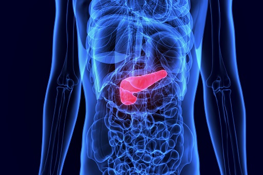 Pancreatite Aguda