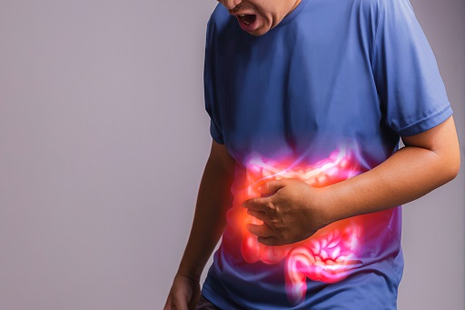 Ulceração e perfuração gastrointestinal